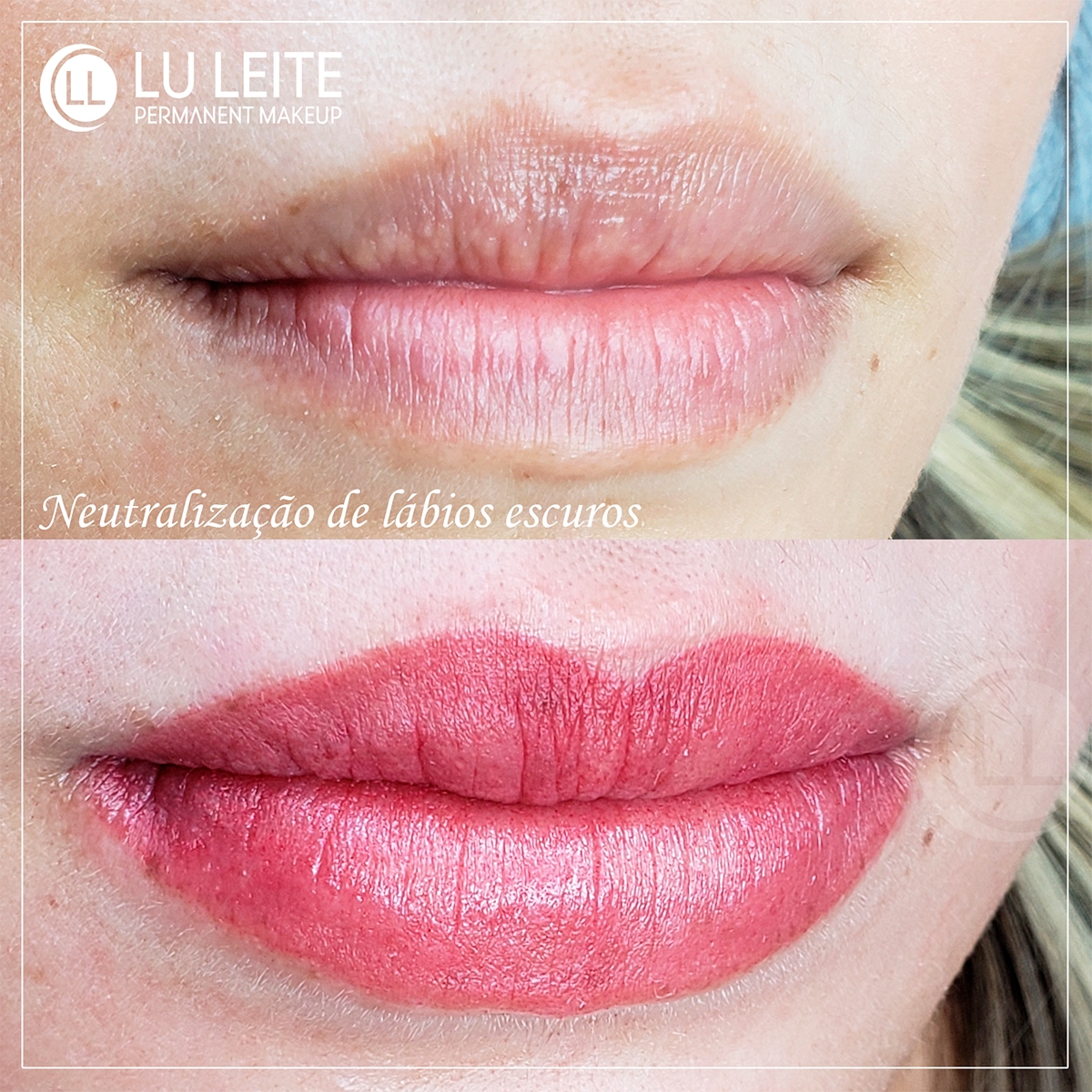 Antes e depois
